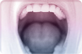 Zahnfarbene Füllungen - direkt oder indirekt: : (Kunststofffüllungen, Keramikinlays)